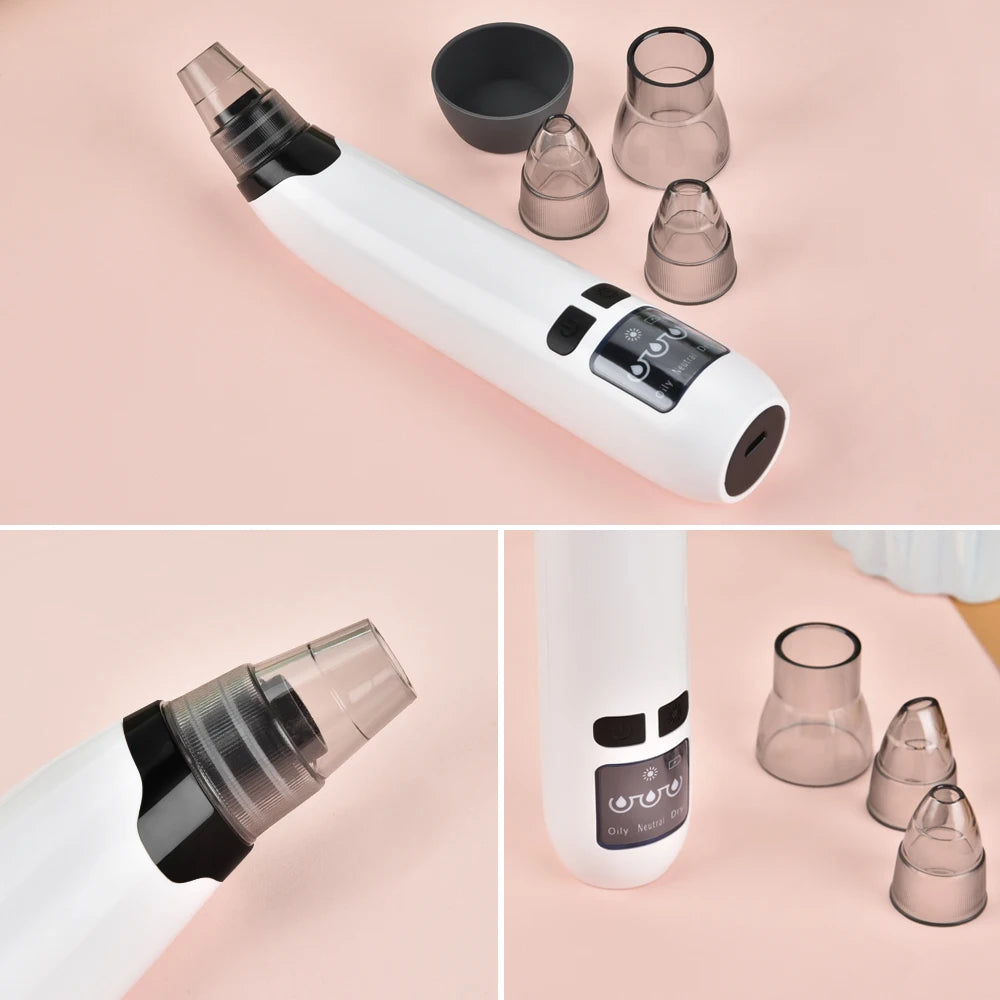 Blackhead Remover Vacuum Acne Pimple Black Spot Suction Electric Facial Pore Cleaner Skincare Exfoliating Beauty Instrument - Artigo Importado