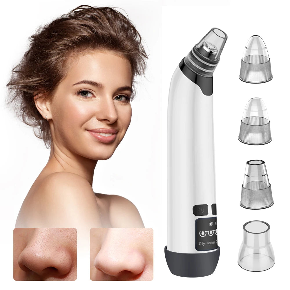 Blackhead Remover Vacuum Acne Pimple Black Spot Suction Electric Facial Pore Cleaner Skincare Exfoliating Beauty Instrument - Artigo Importado