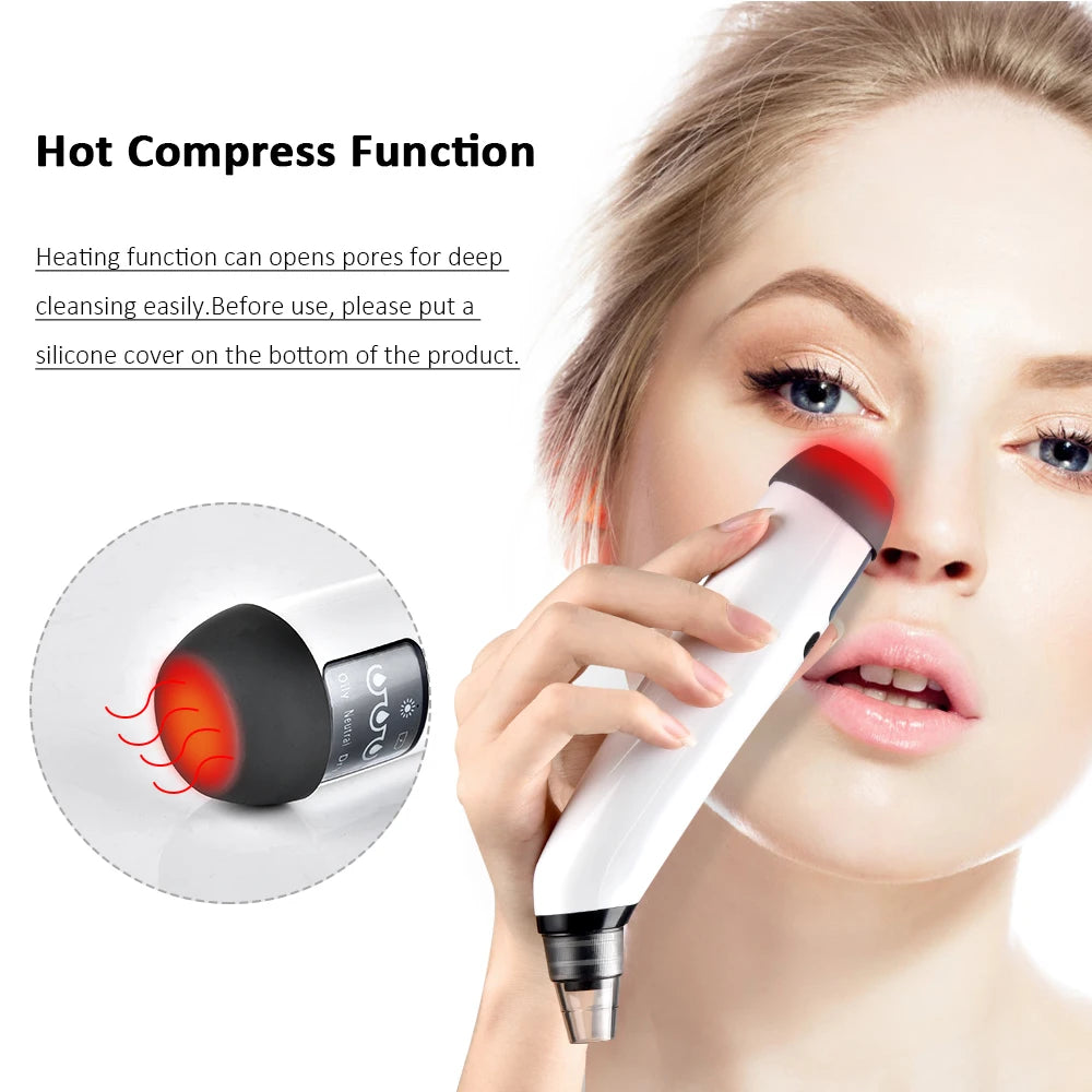 Blackhead Remover Vacuum Acne Pimple Black Spot Suction Electric Facial Pore Cleaner Skincare Exfoliating Beauty Instrument - Artigo Importado