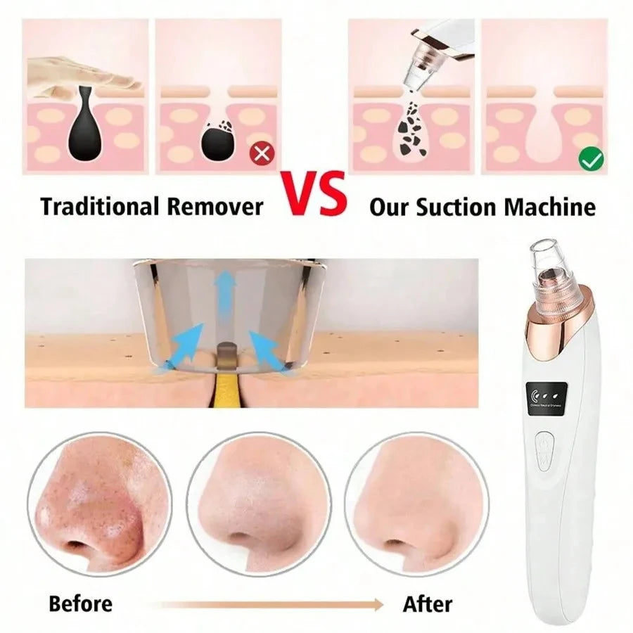 Electric Blackhead Remover Vacuum Cleaner Black Spots Removal Facial Deep Cleansing Pore Cleaner Machine Face Skin Care Tools - Artigo Importado
