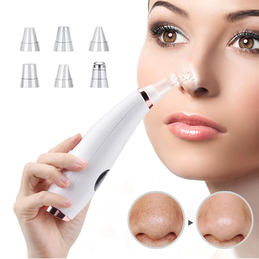 Electric Blackhead Remover Vacuum Acne Cleaner Black Spots Removal Facial Deep Cleansing Pore Cleaner Machine Skin Care Tools - Artigo Importado