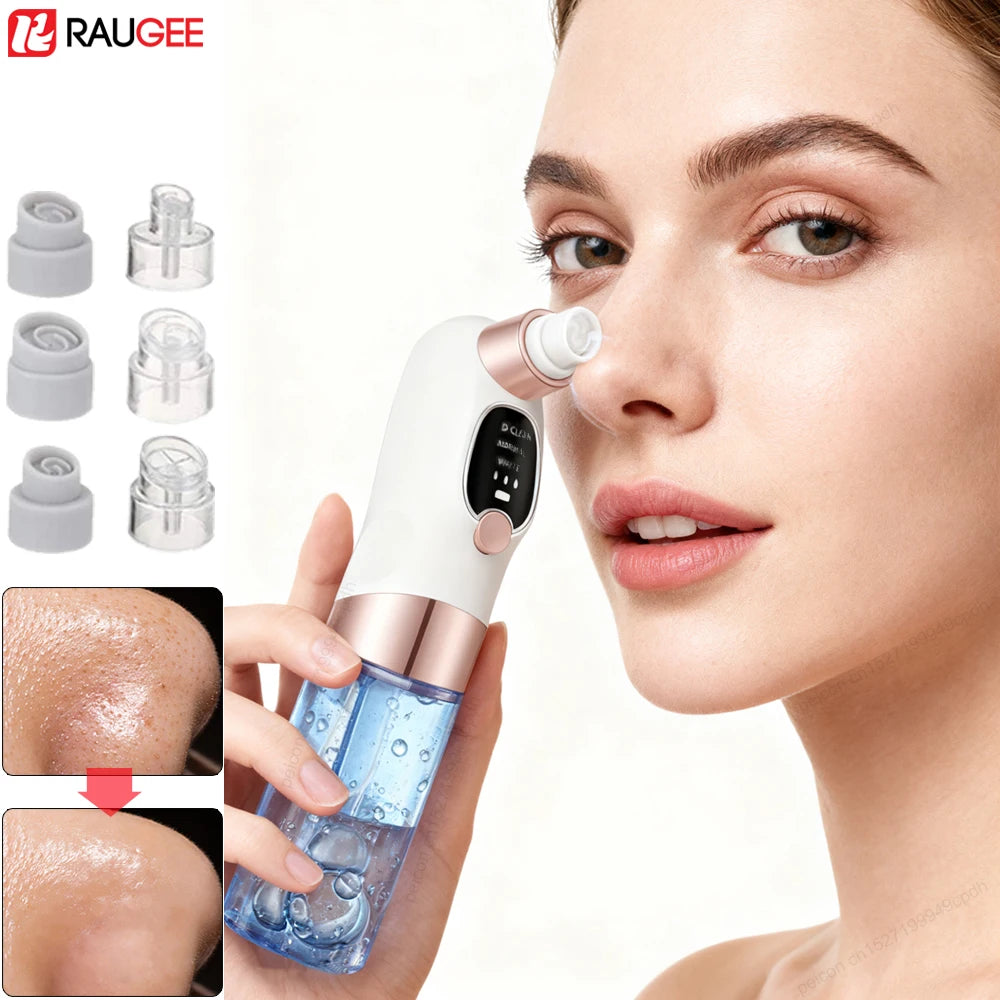 Blackhead Remover Electric Black Head Remover Pore Vacuum Cleaner Micro Small Bubble Rechargeable Water Cycle Black Dot Remove - Artigo Importado