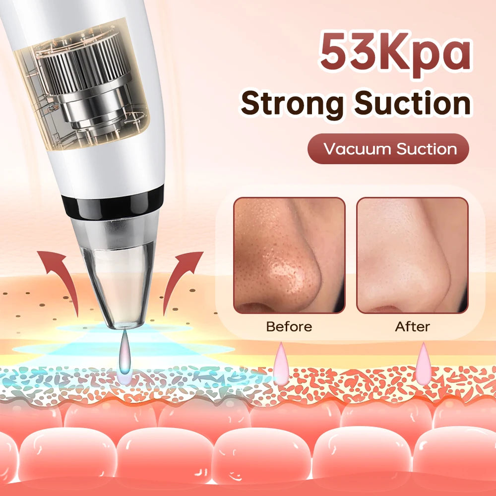 3 Suction Mode Blackhead Remover Face Cleansing Beauty Machine Dead Skin Remover Face Vacuum Blackhead Removal Skin Care Tool - Artigo Importado