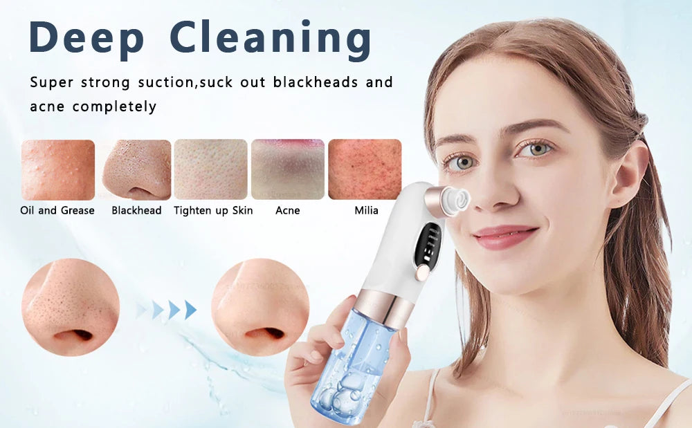 Blackhead Remover Pore Vacuum Face Cleaner Electric Pimple Acne Black Head Removal USB Rechargeable Water Cycle Black Dot Remove - Artigo Importado