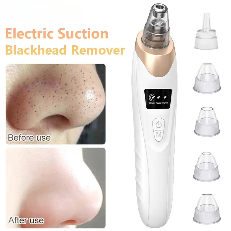 Blackhead Remover Vacuum Suction USB Rechargeable Facial Pore Cleaner Spot Acne Pimple Black Head Deep Extractor Skin Care Kit - Artigo Importado