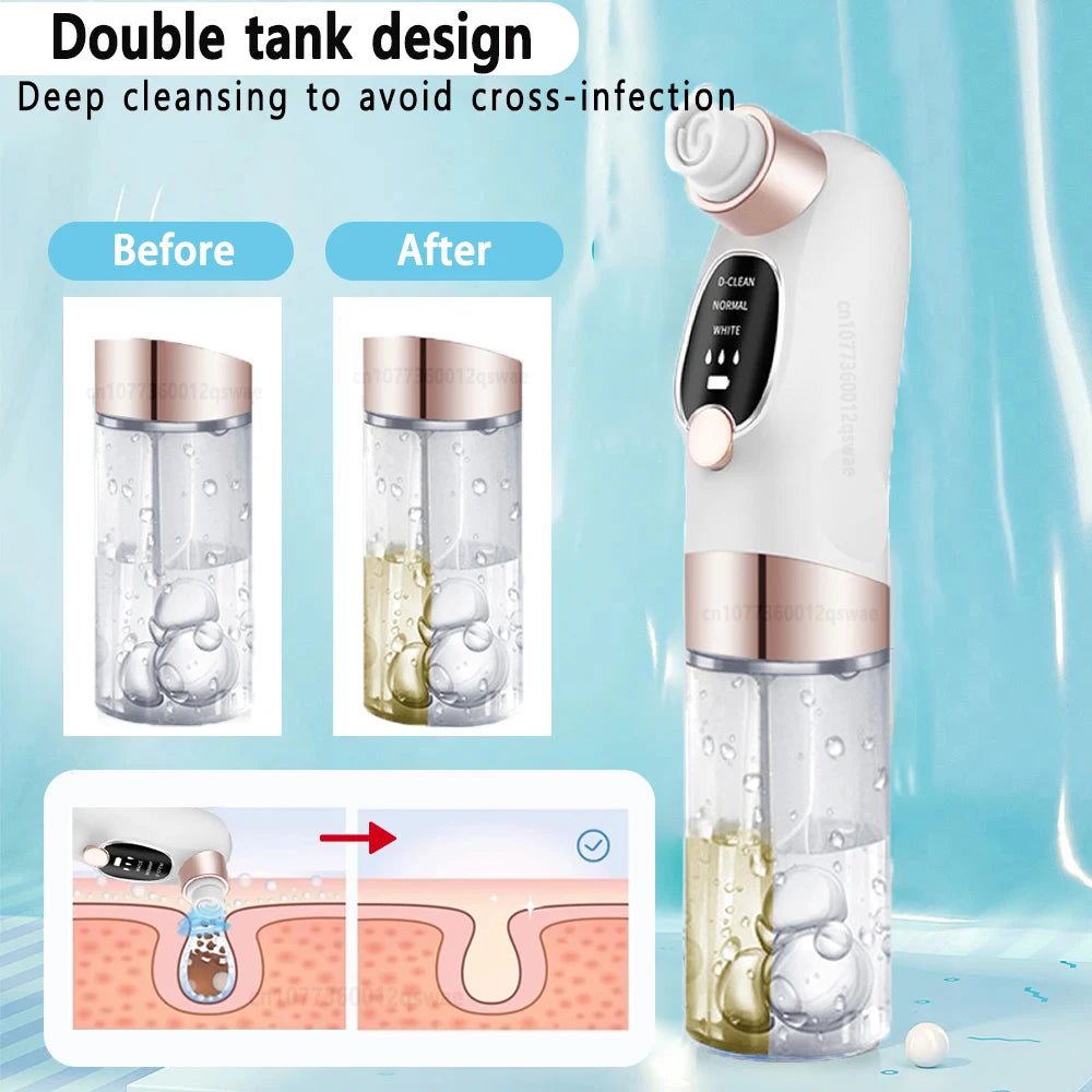 Blackhead Remover Pore Vacuum Face Cleaner Electric Pimple Acne Black Head Removal USB Rechargeable Water Cycle Black Dot Remove - Artigo Importado