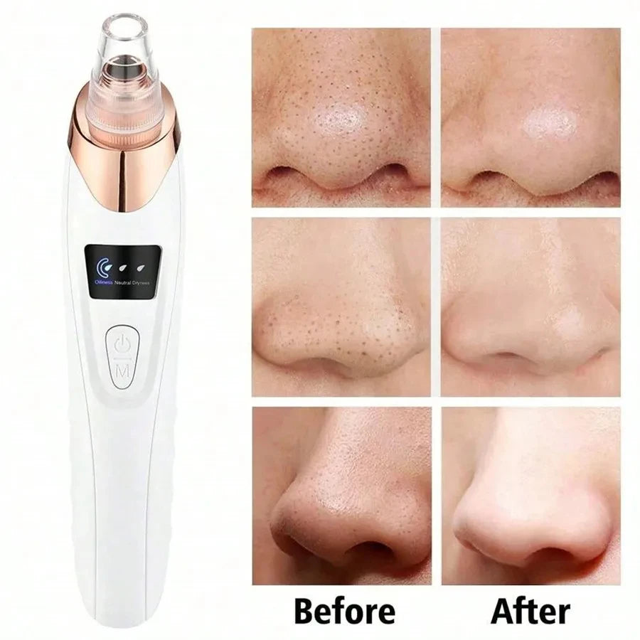 Electric Blackhead Remover Vacuum Cleaner Black Spots Removal Facial Deep Cleansing Pore Cleaner Machine Face Skin Care Tools - Artigo Importado