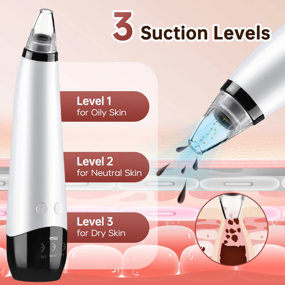 3 Suction Mode Blackhead Remover Face Cleansing Beauty Machine Dead Skin Remover Face Vacuum Blackhead Removal Skin Care Tool - Artigo Importado