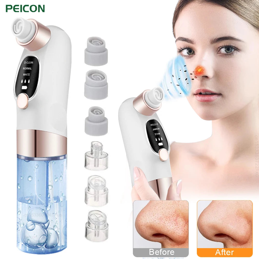 Blackhead Remover Pore Vacuum Cleaner Multifunctional Cleaning Instrument Small Bubble Facial Cleasing Machine Beauty Device - Artigo Importado