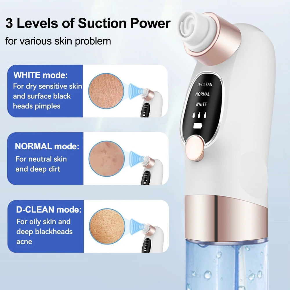 Blackhead Remover Electric Black Head Remover Pore Vacuum Cleaner Micro Small Bubble Rechargeable Water Cycle Black Dot Remove - Artigo Importado