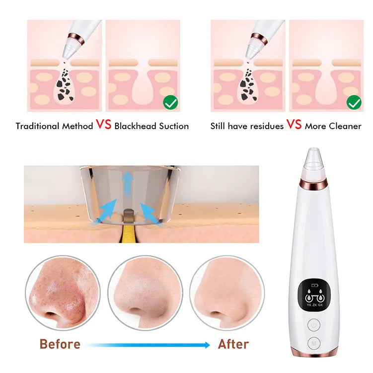 Electric Blackhead Remover Vacuum Acne Cleaner Black Spots Removal Facial Deep Cleansing Pore Cleaner Machine Skin Care Tools - Artigo Importado