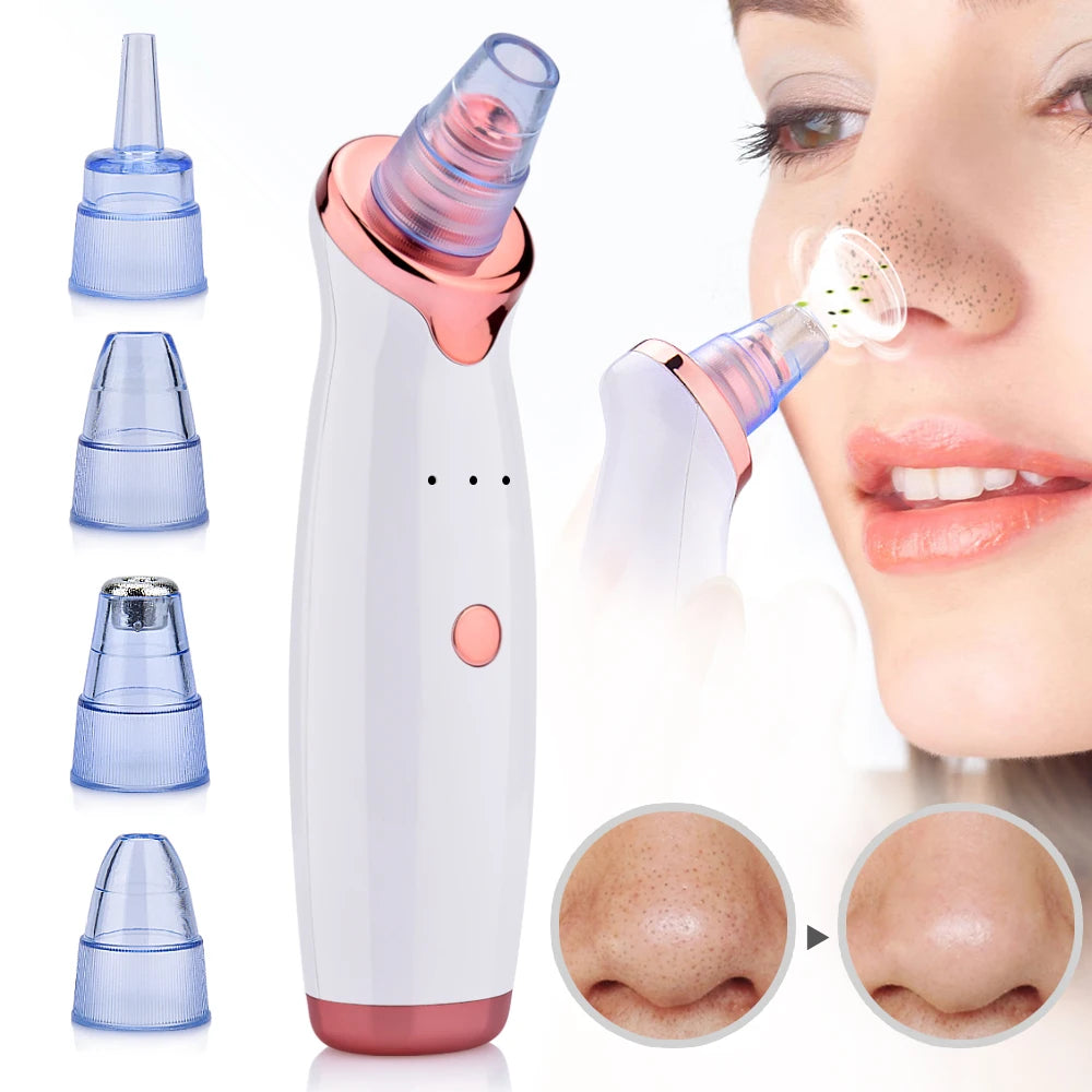 Electric Vacuum Blackhead Removal Facial Cleansing Black Spots Suction Acne Pimple Remover Beauty Instrument Skincare Tools - Artigo Importado