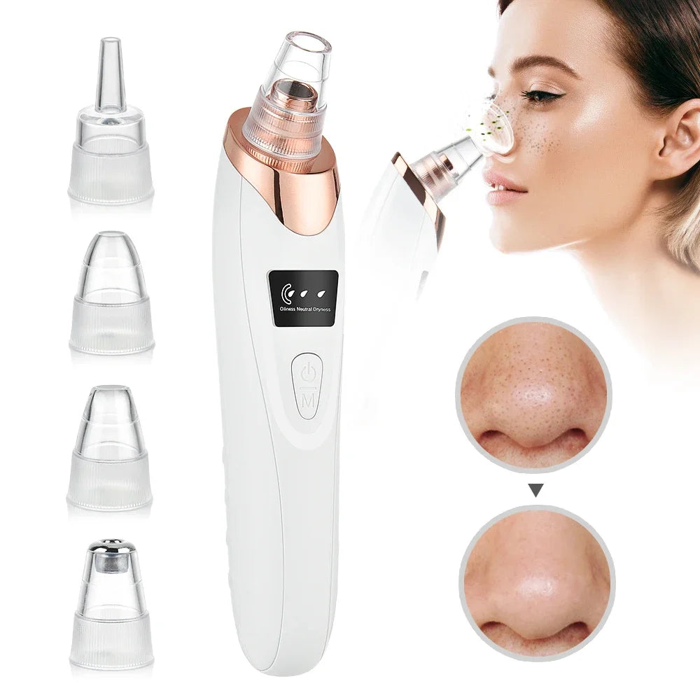 Electric Blackhead Remover Vacuum Acne Cleaner Black Spots Removal Facial Deep Cleansing Pore Cleaner Machine Skin Care Tools - Artigo Importado