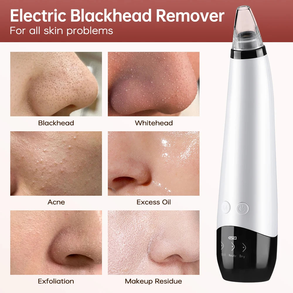 3 Suction Mode Blackhead Remover Face Cleansing Beauty Machine Dead Skin Remover Face Vacuum Blackhead Removal Skin Care Tool - Artigo Importado