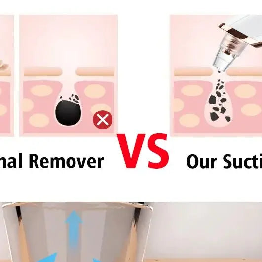 Electric Blackhead Remover Vacuum Cleaner Black Spots Removal Facial Deep Cleansing Pore Cleaner Machine Face Skin Care Tools - Artigo Importado