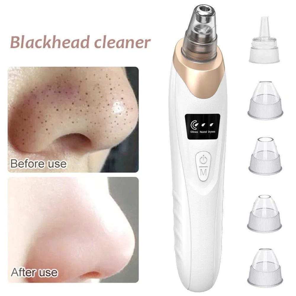 Blackhead Remover PoreVacuum,Facial Pore Cleaner-5 Suction Power,USB Rechargeable Blackhead VacuumKit ElectricAcneExtractorTool - Artigo Importado
