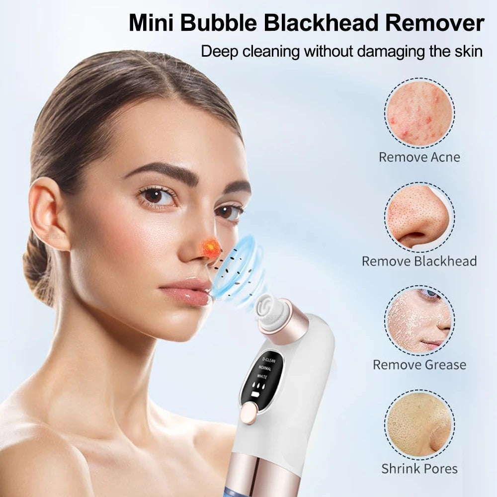 Blackhead Remover Electric Black Head Remover Pore Vacuum Cleaner Micro Small Bubble Rechargeable Water Cycle Black Dot Remove - Artigo Importado