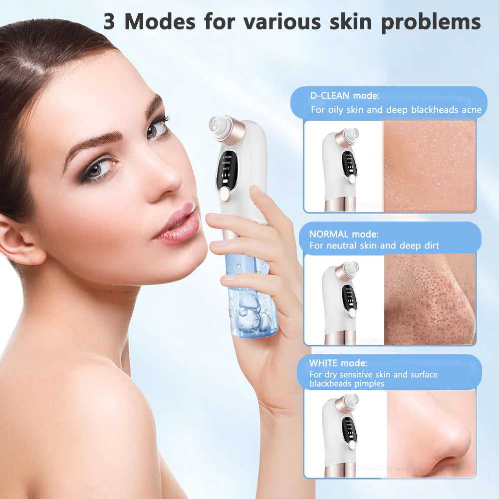 Blackhead Remover Pore Vacuum Face Cleaner Electric Pimple Acne Black Head Removal USB Rechargeable Water Cycle Black Dot Remove - Artigo Importado