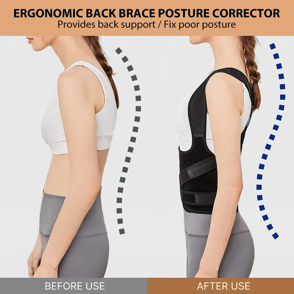 Posture Corrector for Women and Men, Adjustable Back Brace for Scoliosis, Hunchback Correction, Back Support and Posture Trainer - Artigo Importado