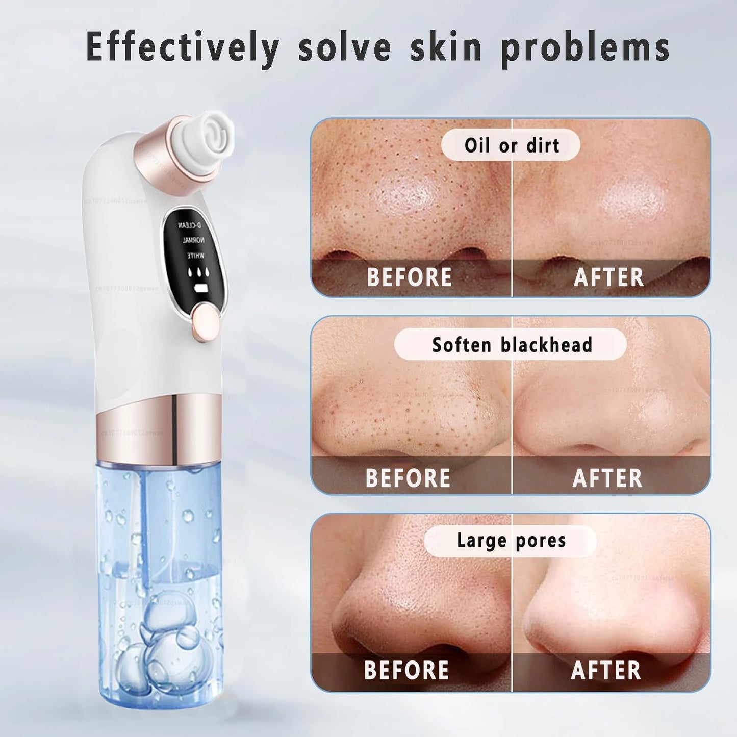 Blackhead Remover Pore Vacuum Face Cleaner Electric Pimple Acne Black Head Removal USB Rechargeable Water Cycle Black Dot Remove - Artigo Importado