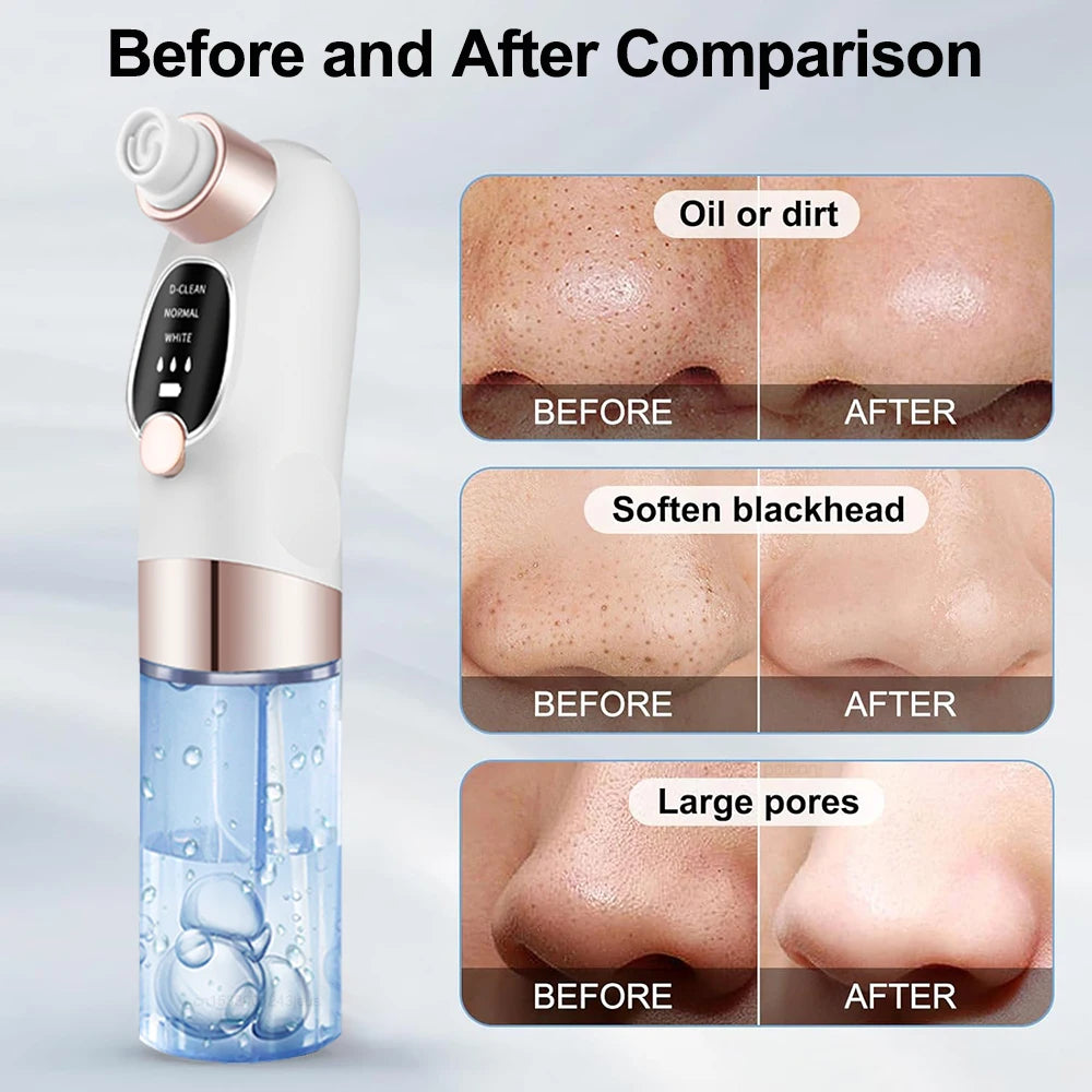 Blackhead Remover Electric Black Head Remover Pore Vacuum Cleaner Micro Small Bubble Rechargeable Water Cycle Black Dot Remove - Artigo Importado