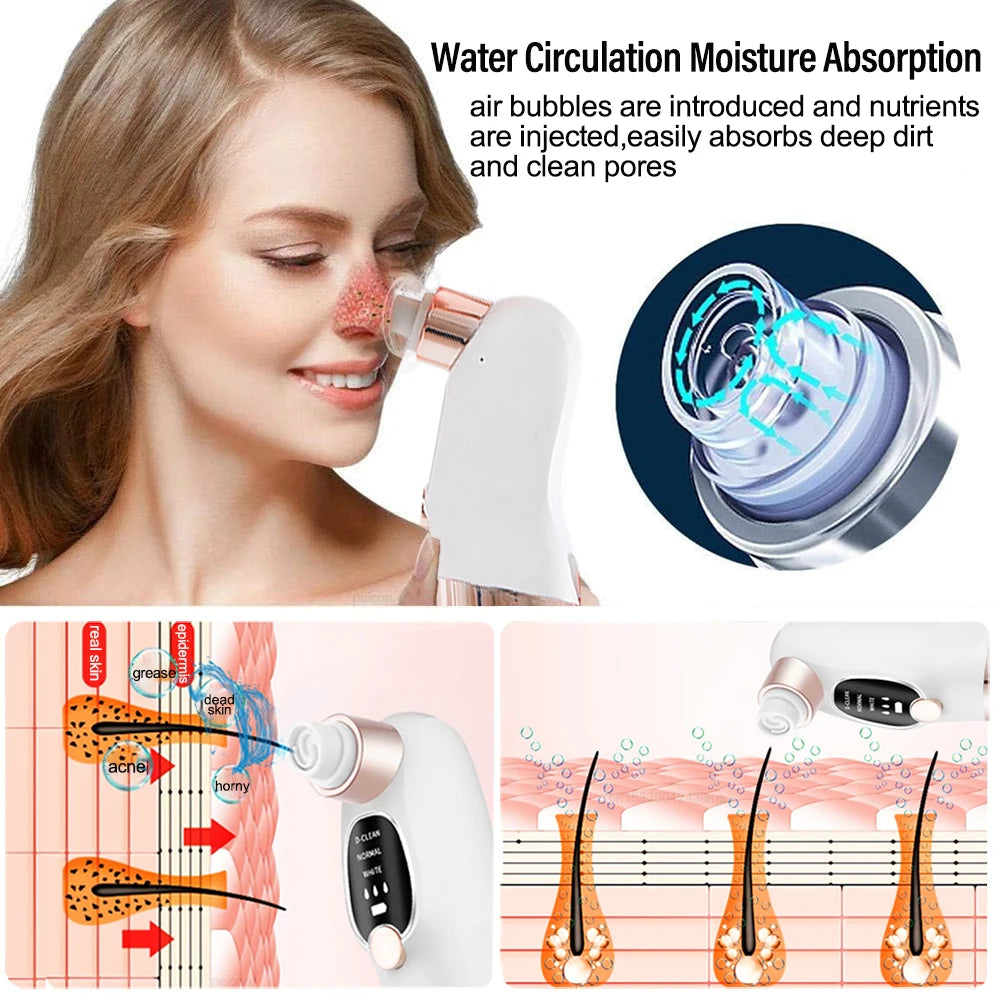 Blackhead Remover Electric Black Head Remover Pore Vacuum Cleaner Micro Small Bubble Rechargeable Water Cycle Black Dot Remove - Artigo Importado