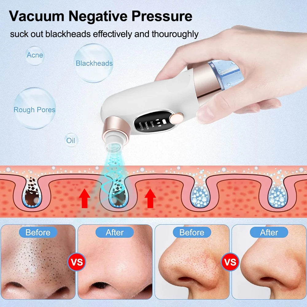 Blackhead Remover Pore Vacuum Cleaner Multifunctional Cleaning Instrument Small Bubble Facial Cleasing Machine Beauty Device - Artigo Importado