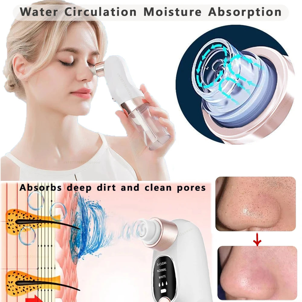 Blackhead Remover Pore Vacuum Face Cleaner Electric Pimple Acne Black Head Removal USB Rechargeable Water Cycle Black Dot Remove - Artigo Importado
