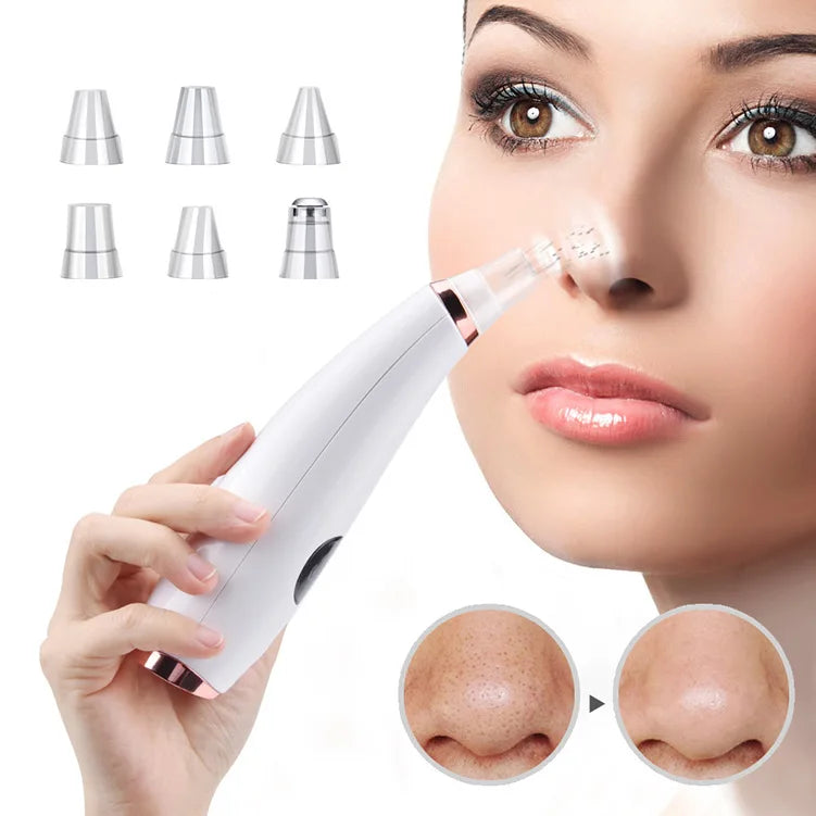 Electric Blackhead Remover Vacuum Acne Cleaner Black Spots Removal Facial Deep Cleansing Pore Cleaner Machine Skin Care Tools - Artigo Importado